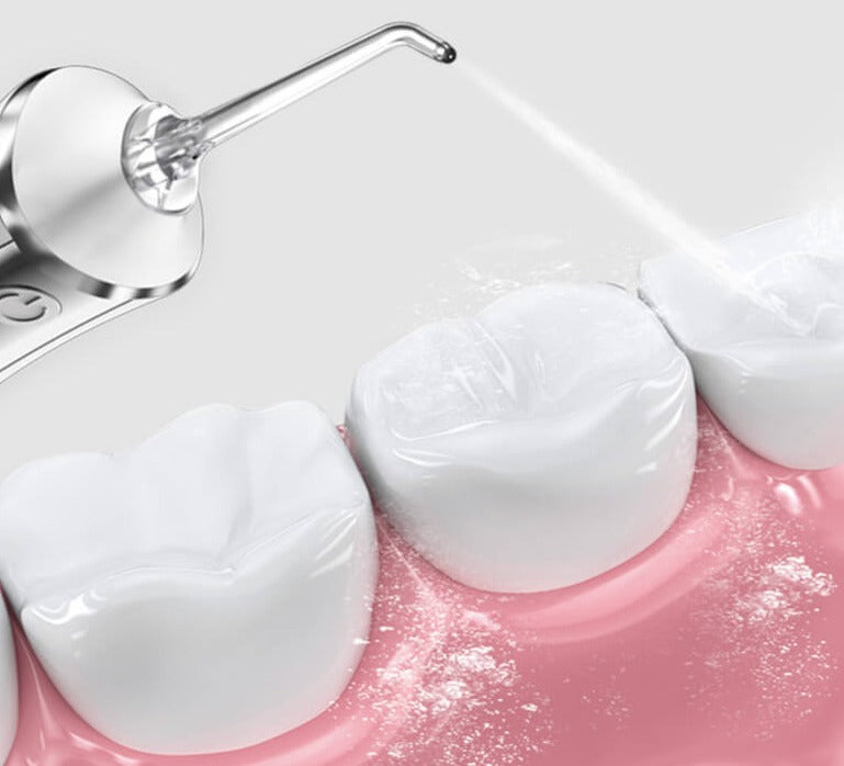 Portable Dental Water Flosser – Rechargeable, Adjustable Pressure, 5 Jet Tips