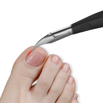 NailCutter Pro – Precision Toenail Clipper for Ingrown Nails & Tough Nail Problems