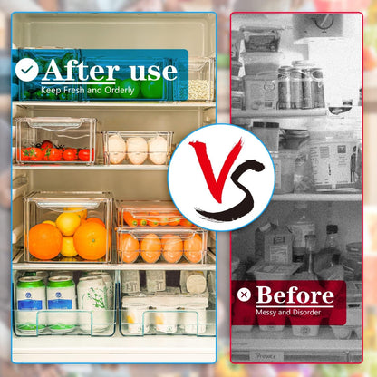 Stackable Fridge Organiser Set – 10 Clear Storage Boxes for Freshness & Kitchen Order