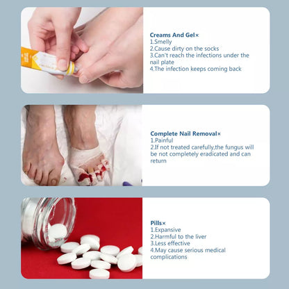 Nail Fungus Laser Treatment Device | Dual Wavelength Therapy 905nm & 470nm