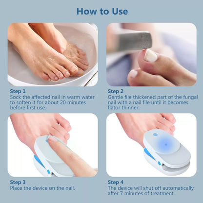 Nail Fungus Laser Treatment Device | Dual Wavelength Therapy 905nm & 470nm